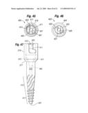 One step entry pedicular preparation device and disc access system diagram and image