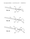 GASTRIC RETAINING DEVICES AND METHODS diagram and image