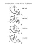 GASTRIC RETAINING DEVICES AND METHODS diagram and image