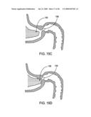 GASTRIC RETAINING DEVICES AND METHODS diagram and image