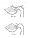 GASTRIC RETAINING DEVICES AND METHODS diagram and image