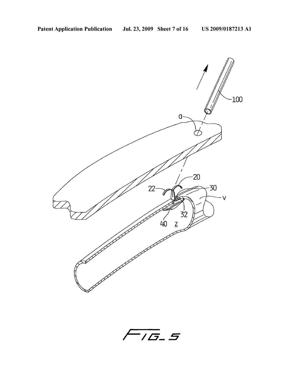 Vascular hole closure device - diagram, schematic, and image 08