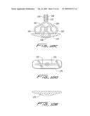 Vascular hole closure device diagram and image