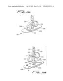 Vascular hole closure device diagram and image