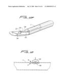 Vascular hole closure device diagram and image