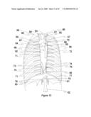 Method and apparatus for programming of autonomic neuromodulation for the treatment of obesity diagram and image