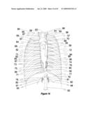 Method and apparatus for programming of autonomic neuromodulation for the treatment of obesity diagram and image