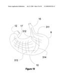 Method and apparatus for programming of autonomic neuromodulation for the treatment of obesity diagram and image