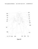 Method and apparatus for programming of autonomic neuromodulation for the treatment of obesity diagram and image