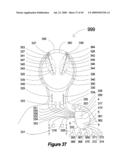 Method and apparatus for programming of autonomic neuromodulation for the treatment of obesity diagram and image