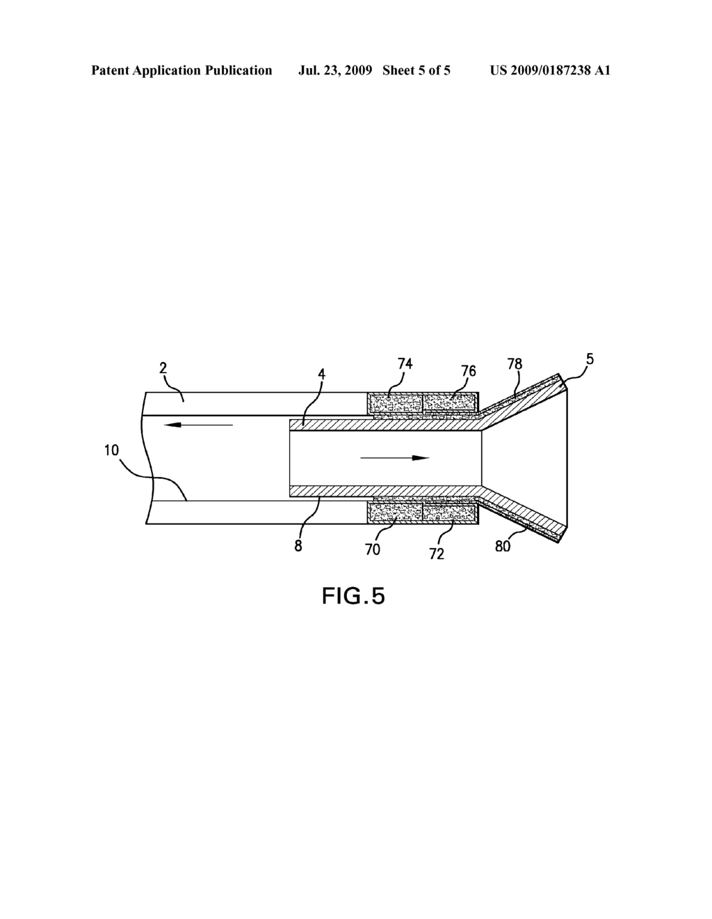 SYSTEM AND METHOD FOR DEPLOYING SELF-EXPANDABLE MEDICAL DEVICE WITH COATING - diagram, schematic, and image 06