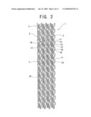 STENT, STENT DELIVERY DEVICE AND STENT DELIVERY METHOD diagram and image