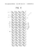 STENT, STENT DELIVERY DEVICE AND STENT DELIVERY METHOD diagram and image