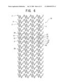 STENT, STENT DELIVERY DEVICE AND STENT DELIVERY METHOD diagram and image