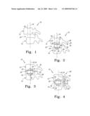 Interbody implants for spinal alignment procedures diagram and image