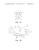 Interbody implants for spinal alignment procedures diagram and image