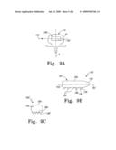 Interbody implants for spinal alignment procedures diagram and image