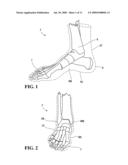 Method of manufacturing an ice skate diagram and image