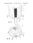 Tree Support and Cover System diagram and image