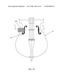 ANTI-WOLF-NOTE RESONATOR ASSEMBLY FOR A STRING INSTRUMENT AND METHOD OF ASSEMBLING THE SAME diagram and image