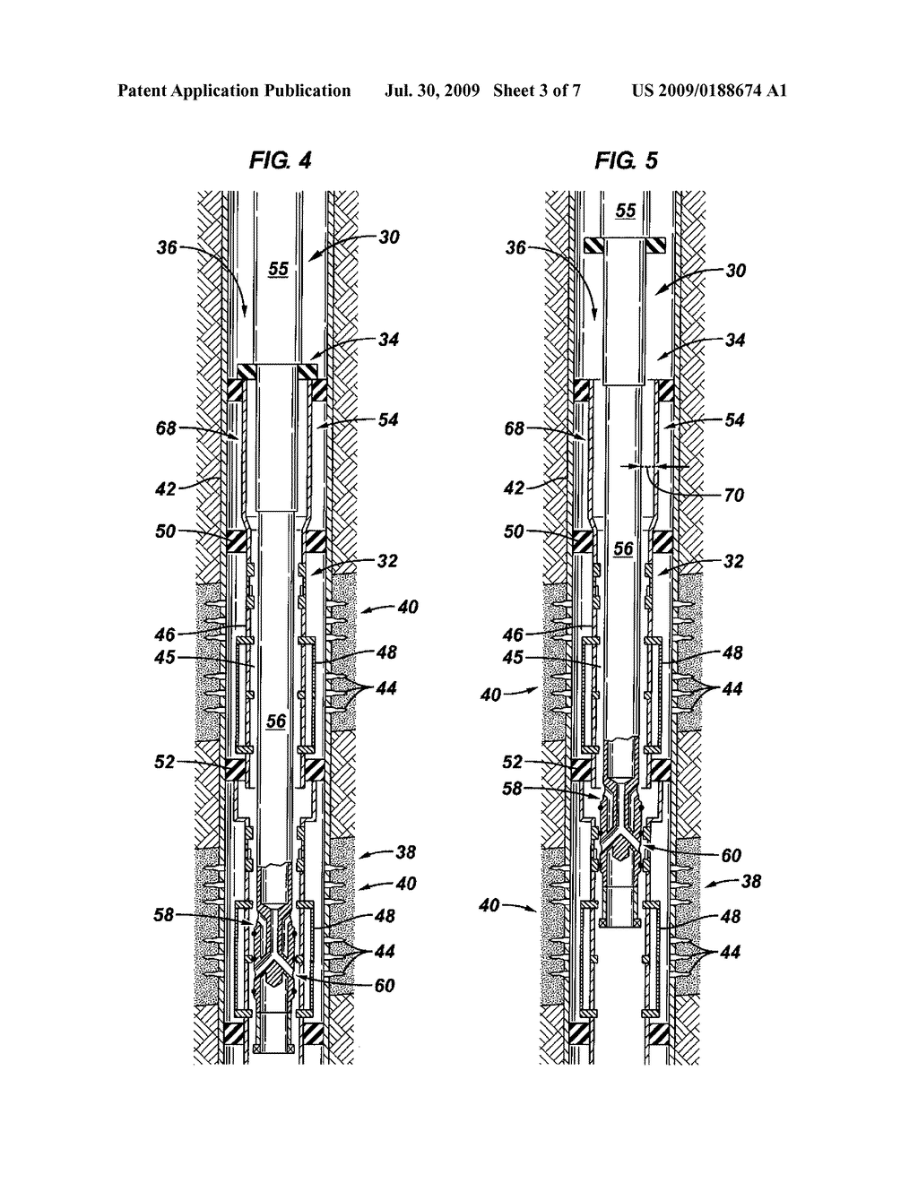 SYSTEM AND METHOD FOR PREVENTING BUCKLING DURING A GRAVEL PACKING OPERATION - diagram, schematic, and image 04