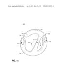 APPARATUS FOR CARRYING ONE OR MORE SUSPENDED ITEMS diagram and image