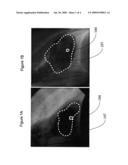 Medical Image Data Processing and Feature Identification System diagram and image