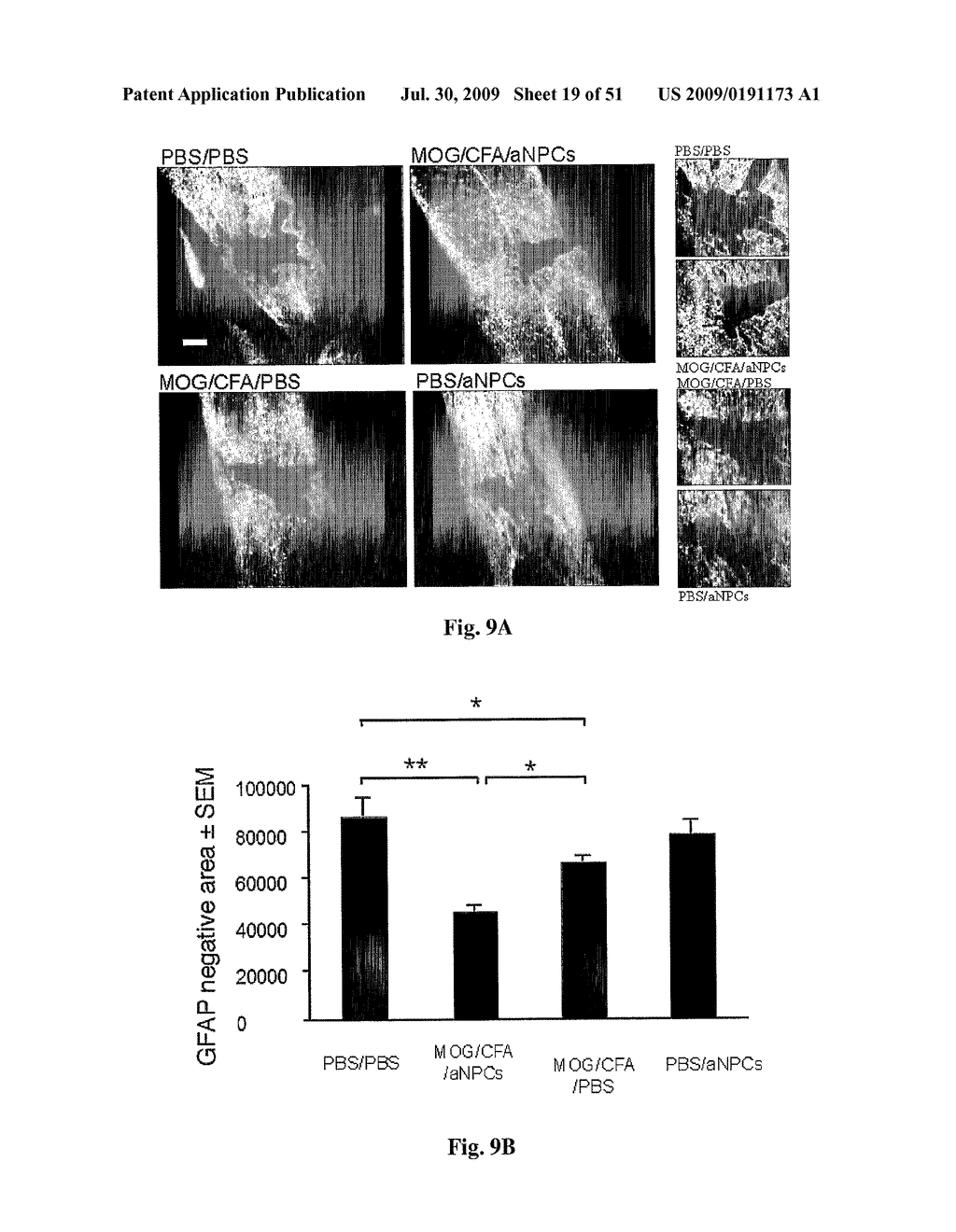 Induction Of Neurogenesis And Stem Cell Therapy In Combination With Copolymer 1 - diagram, schematic, and image 20