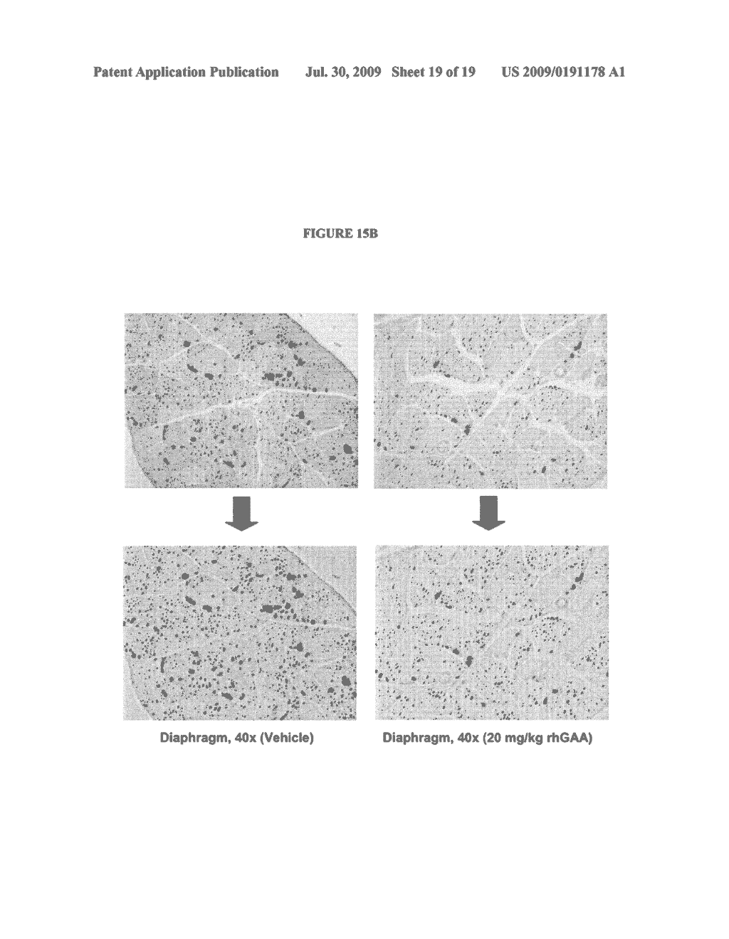 Manufacture of Highly Phosphorylated Lysosomal Enzymes and Uses Thereof - diagram, schematic, and image 20