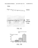 Reducing Cancer Cell Invasion Using an Inhibitor of Toll Like Receptor Signaling diagram and image