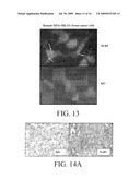 Reducing Cancer Cell Invasion Using an Inhibitor of Toll Like Receptor Signaling diagram and image