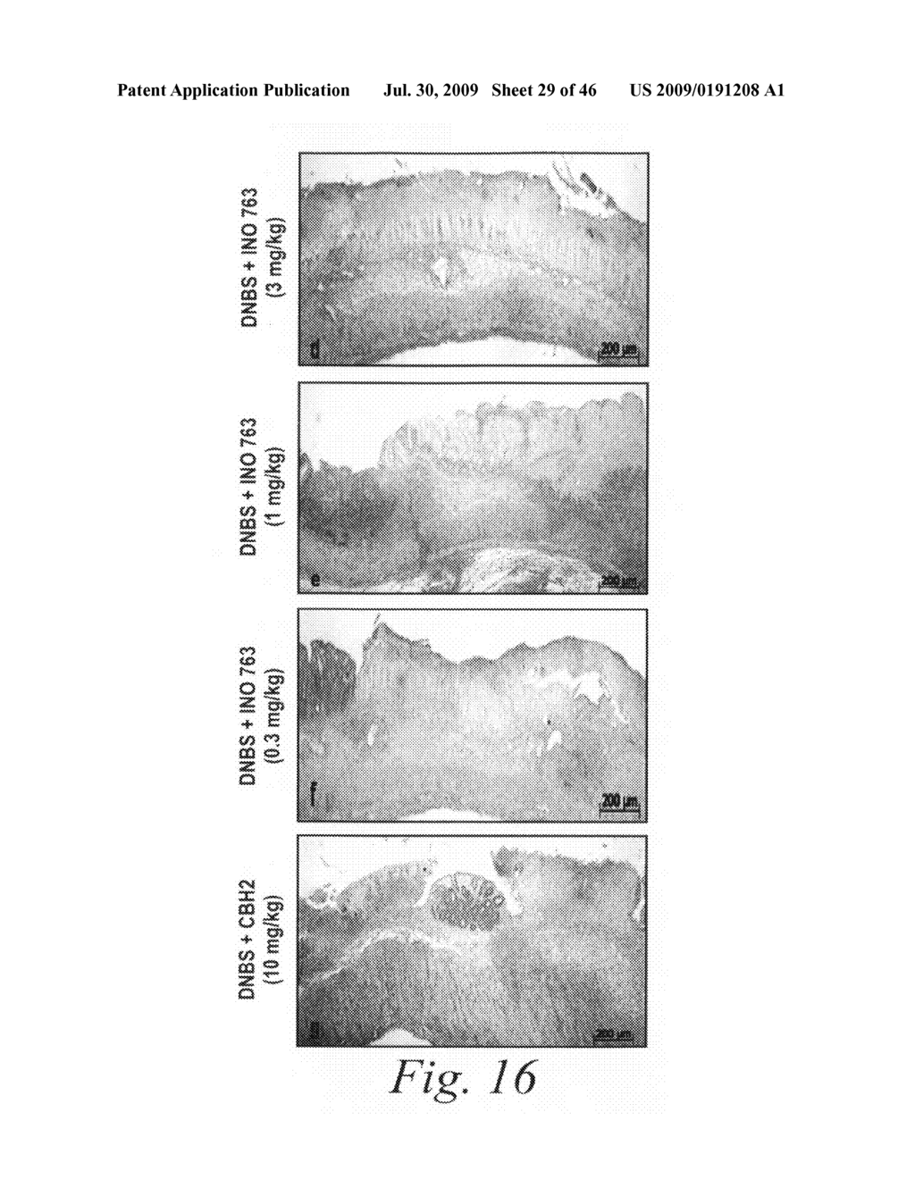 Antibodies against flagellin and uses thereof - diagram, schematic, and image 30