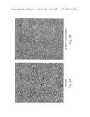 BMP-1 PROCOLLAGEN C-PROTEINASE FOR DIAGNOSIS AND TREATMENT OF BONE AND SOFT TISSUE DEFECTS AND DISORDERS diagram and image