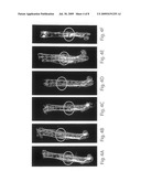 BMP-1 PROCOLLAGEN C-PROTEINASE FOR DIAGNOSIS AND TREATMENT OF BONE AND SOFT TISSUE DEFECTS AND DISORDERS diagram and image