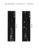 BMP-1 PROCOLLAGEN C-PROTEINASE FOR DIAGNOSIS AND TREATMENT OF BONE AND SOFT TISSUE DEFECTS AND DISORDERS diagram and image