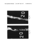 BMP-1 PROCOLLAGEN C-PROTEINASE FOR DIAGNOSIS AND TREATMENT OF BONE AND SOFT TISSUE DEFECTS AND DISORDERS diagram and image