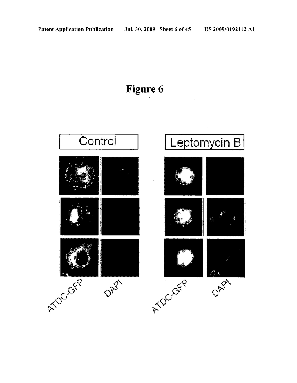 COMPOSITIONS AND METHODS FOR TREATING CANCER - diagram, schematic, and image 07