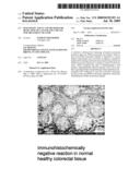 DIAGNOSTIC AGENT AND METHOD FOR DETECTION OF CANCER AND A MEANS FOR TREATMENT OF SAME diagram and image