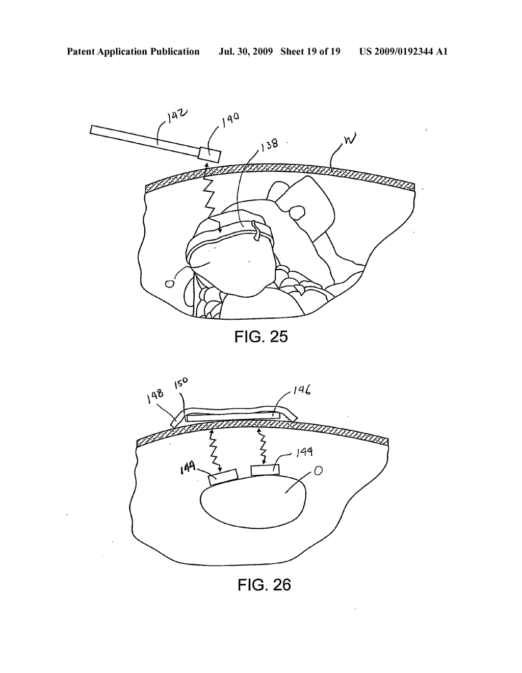 SURGICAL DEVICES FOR MANIPULATING TISSUE - diagram, schematic, and image 20