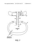 ROTATABLE OPERATION DEVICE FOR ENDOSCOPE diagram and image