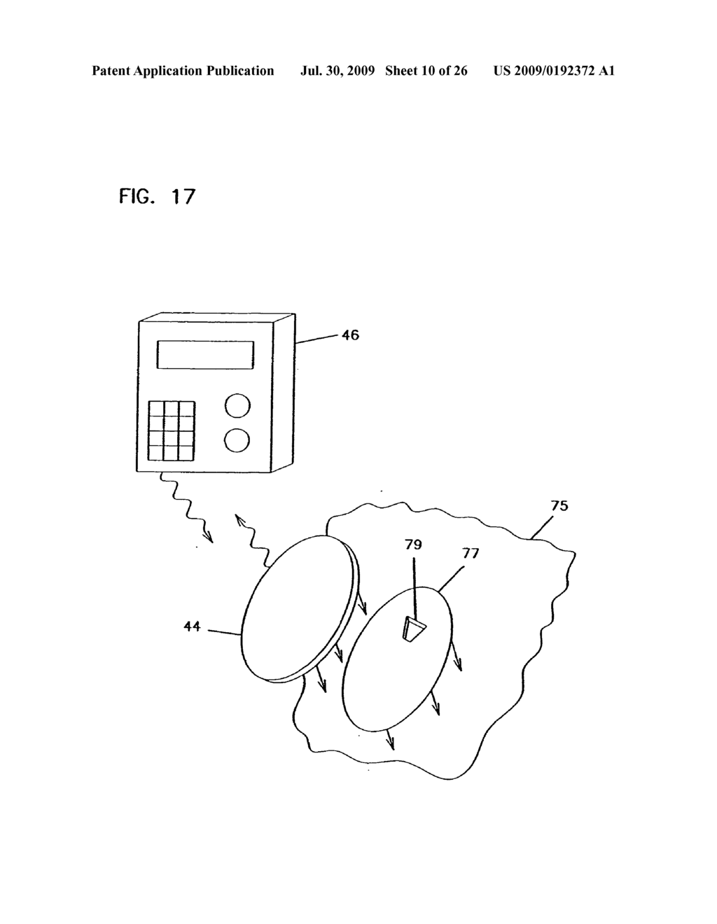 Analyte Monitoring Device and Methods of Use - diagram, schematic, and image 11