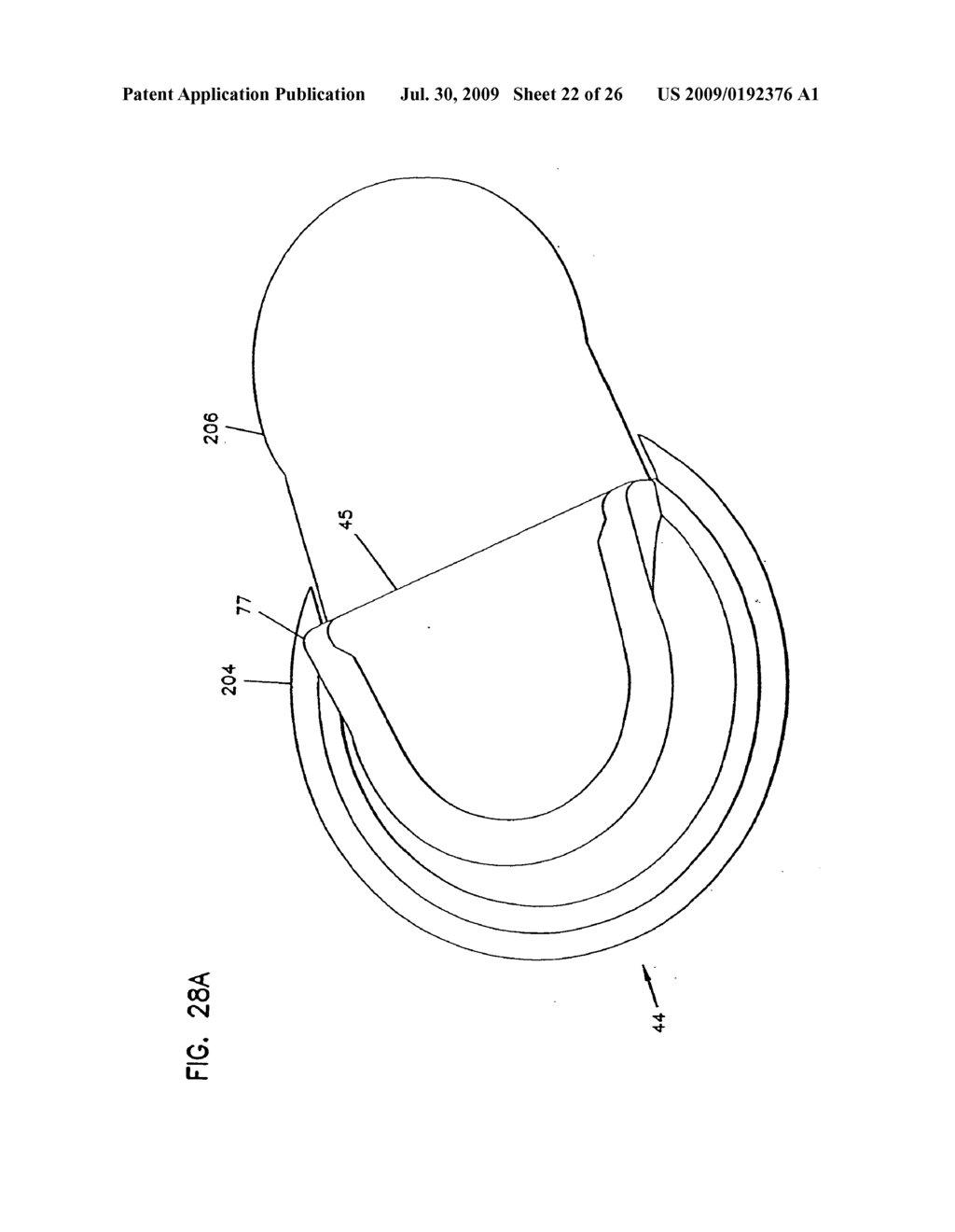 Analyte Monitoring Device and Methods of Use - diagram, schematic, and image 23