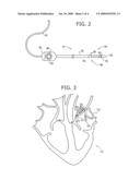 DETERMINING LOCATIONS OF GANGLIA AND PLEXI IN THE HEART USING COMPLEX FRACTIONATED ATRIAL ELECTROGRAM diagram and image