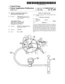 DEVICE AND METHOD FOR RADIAL PRESSURE DETERMINATION diagram and image