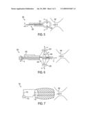 DEVICE AND METHOD FOR RADIAL PRESSURE DETERMINATION diagram and image