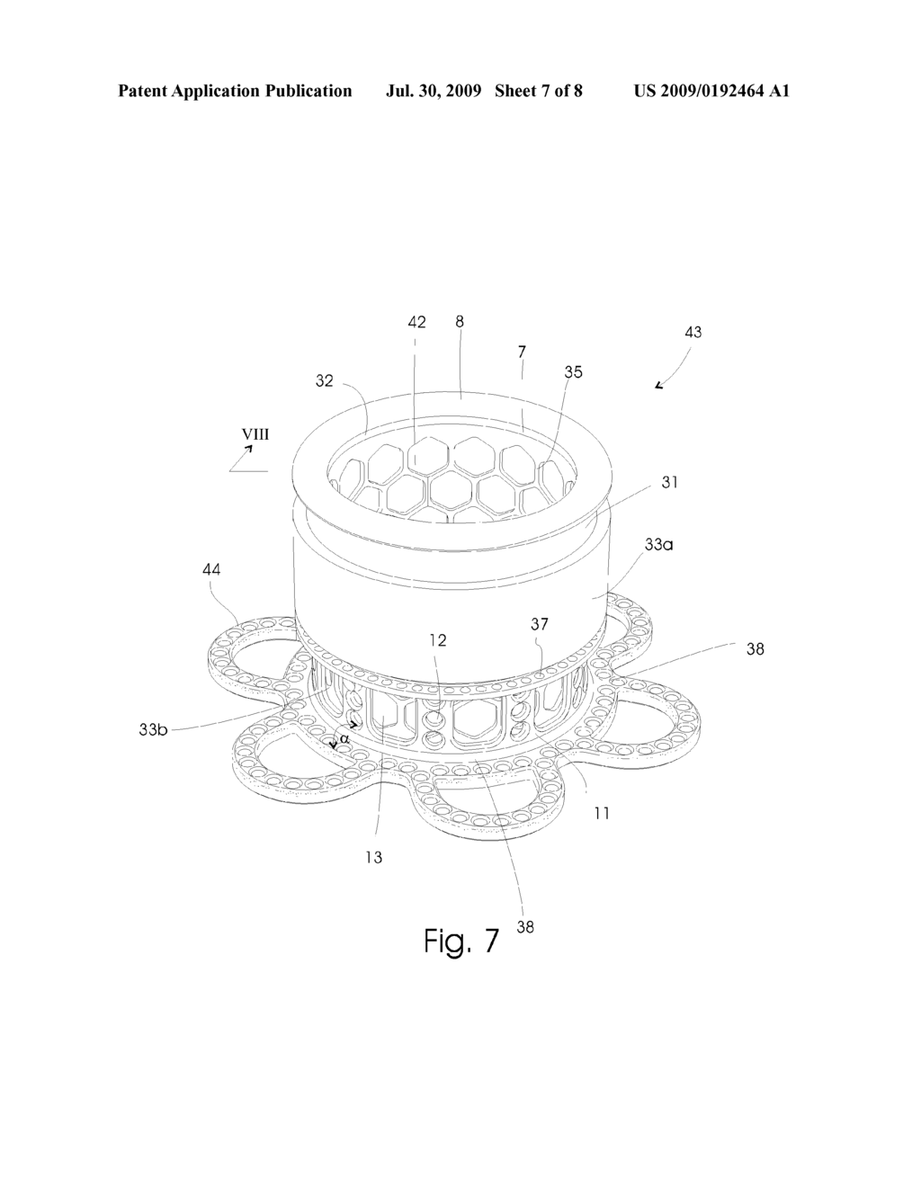 IMPLANT AND METHOD FOR ITS MANUFACTURE - diagram, schematic, and image 08