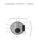 DEVICE AND METHOD FOR TREATMENT OF EYELID DISEASES diagram and image