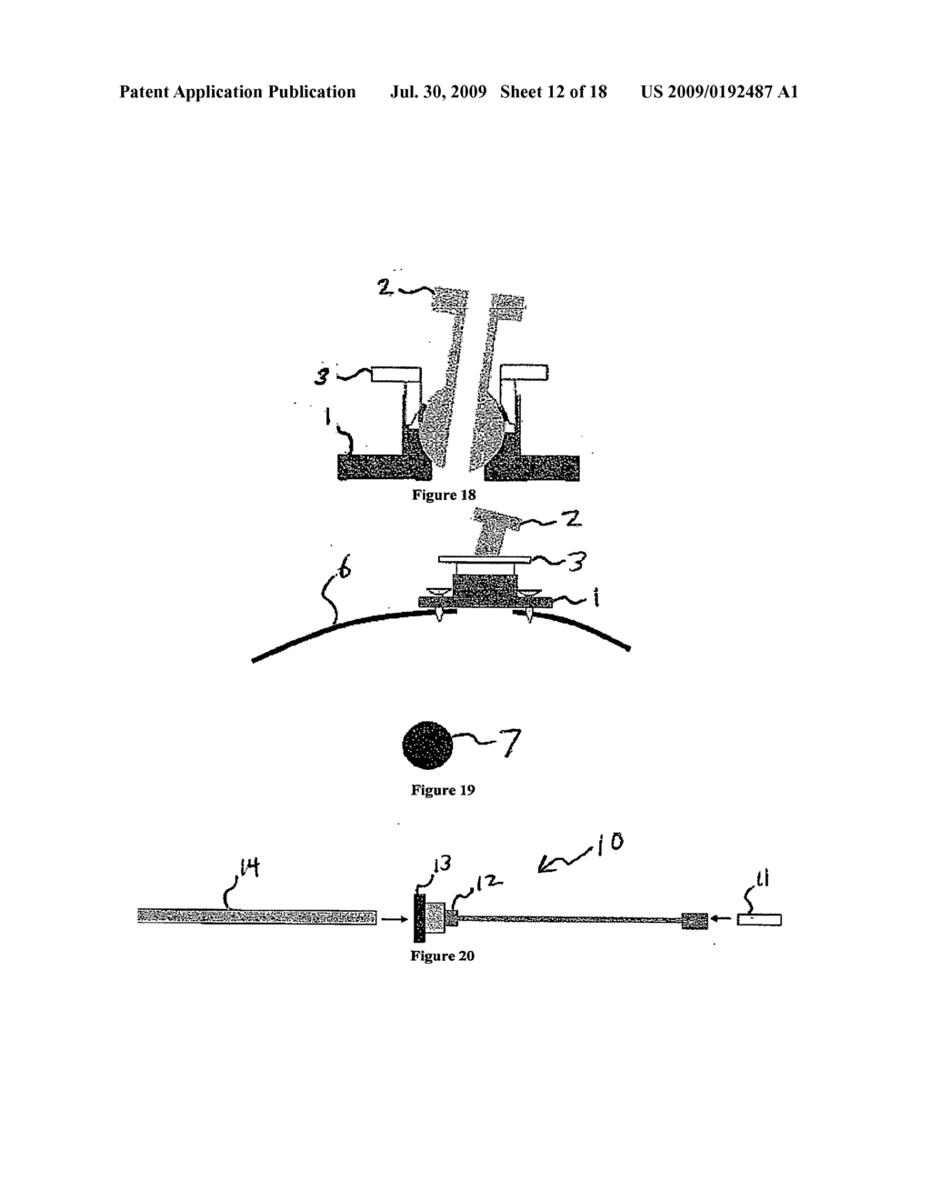 System and Method for Intracranial Implantation of Therapeutic or Diagnostic Agents - diagram, schematic, and image 13