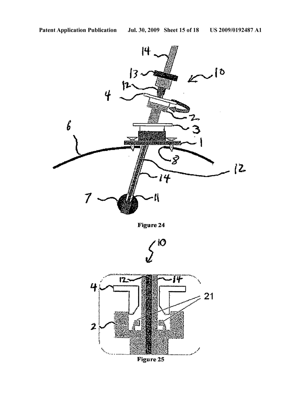 System and Method for Intracranial Implantation of Therapeutic or Diagnostic Agents - diagram, schematic, and image 16