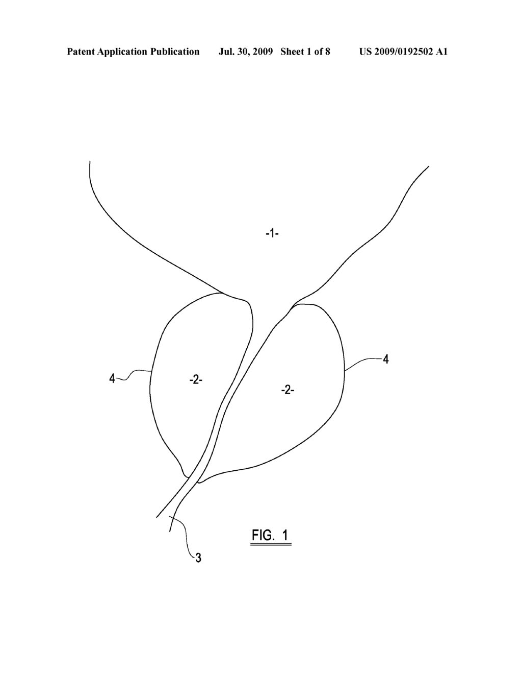 ABLATION DEVICE - diagram, schematic, and image 02